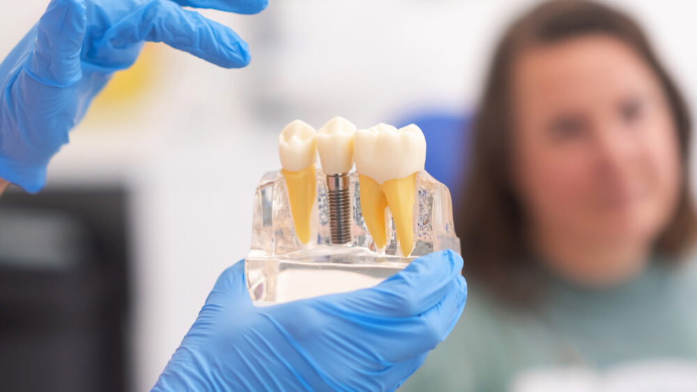 jak uzupełnić brak tylnych zębów za pomocą implantów